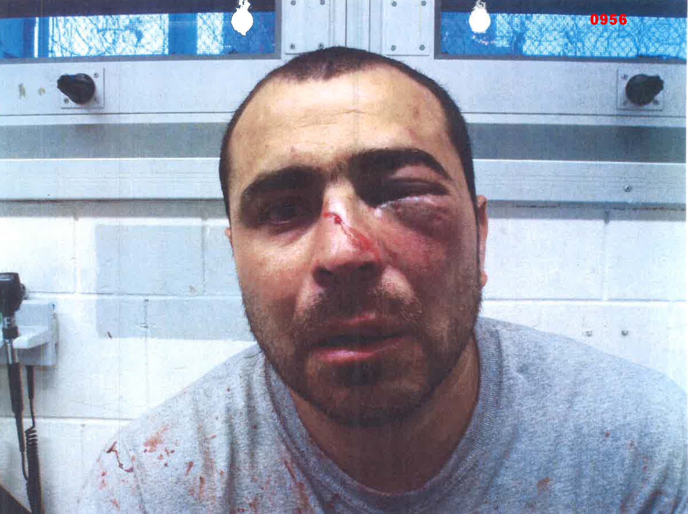 09 - Sanchez Injury Photo (Facility Inv)