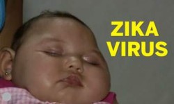 Zika Virus Appears In The City